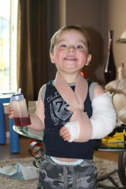Lachlan after surgery